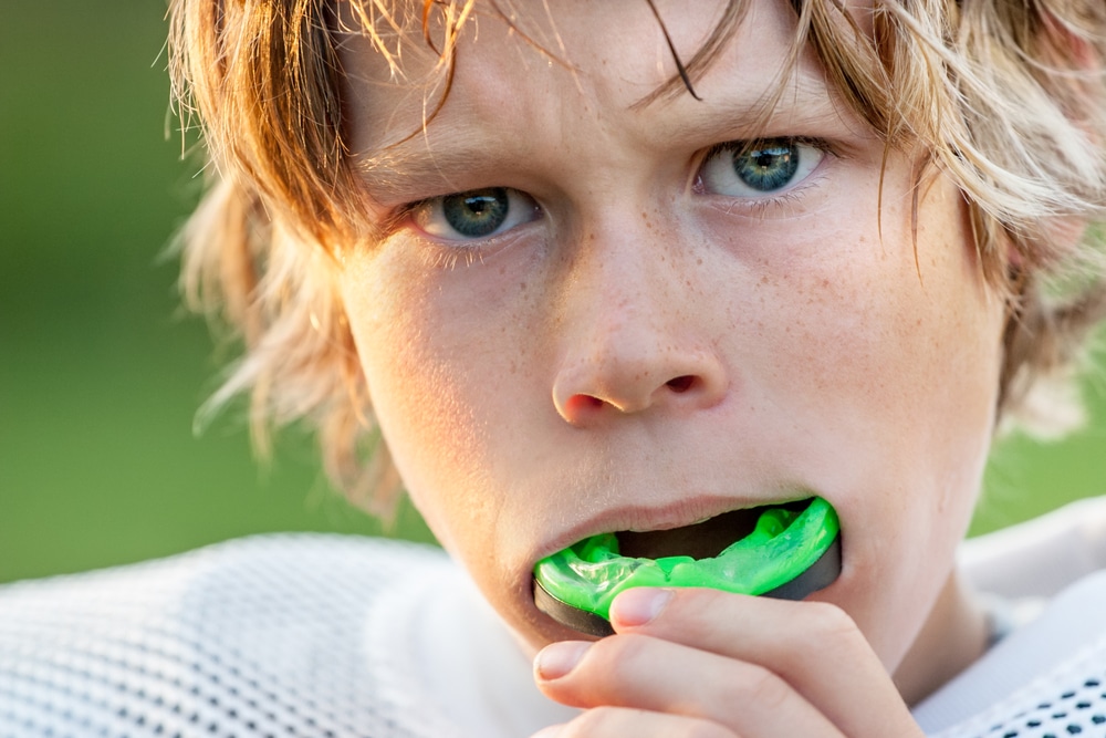 Ask Your Port Lavaca Dentist: Sports Mouth Guards