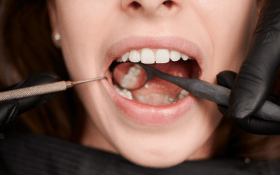 Benefits Of Regular Dental Check-Ups For A Healthy Smile