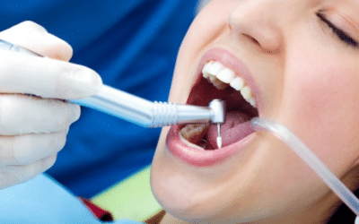 How Does Root Canal Therapy Treat Decayed Teeth?