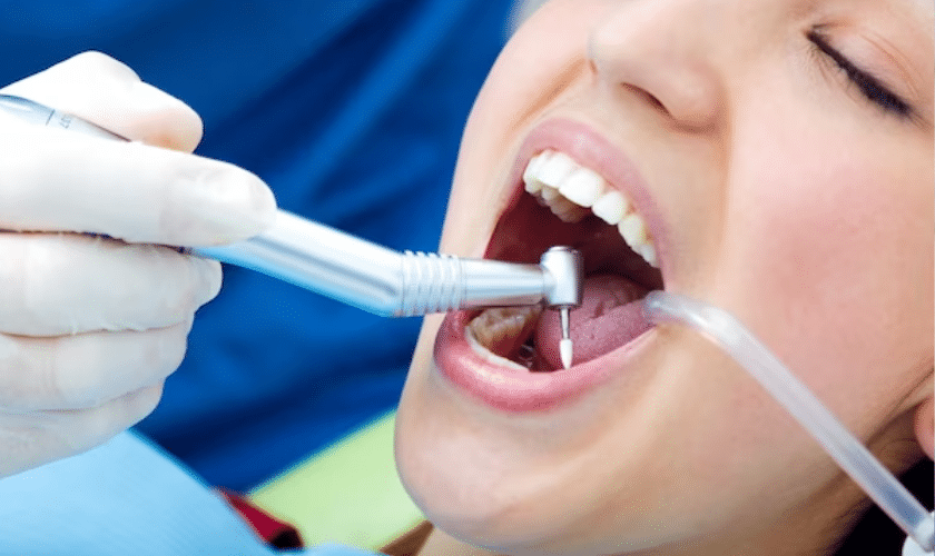 Root Canal Therapy in Port Lavaca