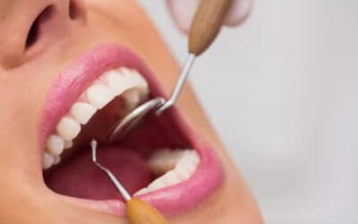 5 Tips for Ensuring the Longevity of Your Dental Veneers