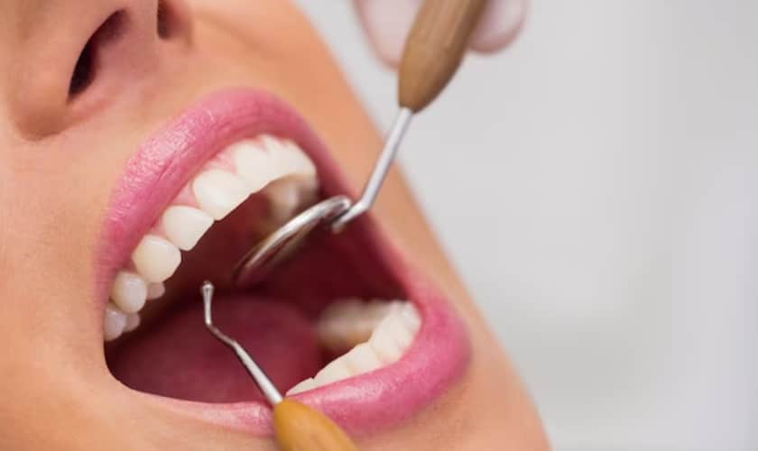5 Tips for Ensuring the Longevity of Your Dental Veneers