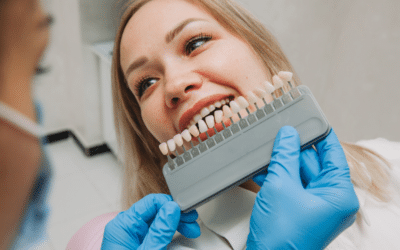 Teeth Whitening : The Secret To A Brighter, Whiter Smile
